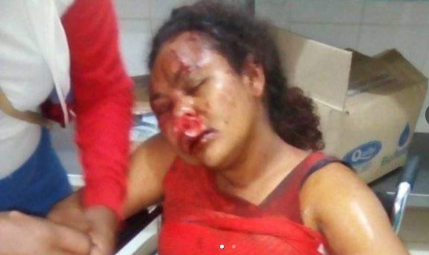 Imagen de la victima de agresión / tomada de El Meridiano